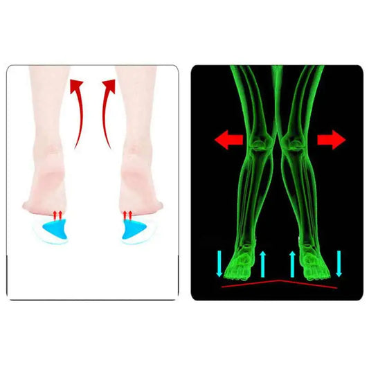 2Pc Arch Support Insole Of Flatfoot Gel Pads For Feet Orthotics Insoles Foot Health Care Massage Muscle Resist Painful Massager