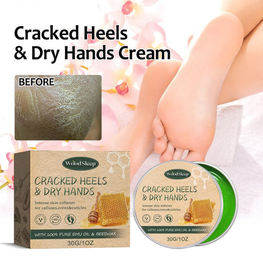 Anti-Crack Hand And Foot Care Cream Moisturizes Skin To Prevent Dry Cracking, Peeling, Freezing And Chapping