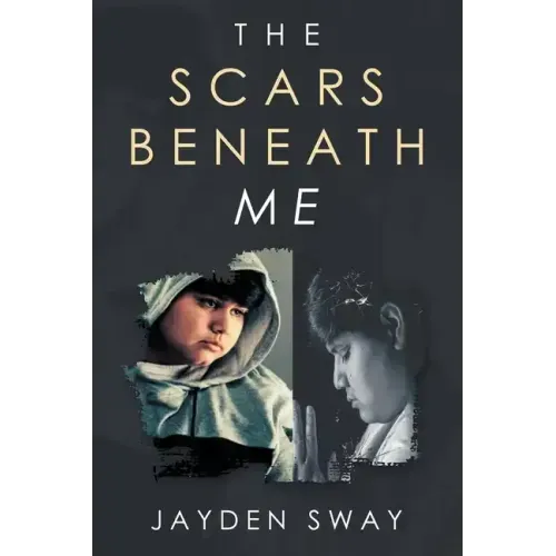 The Scars Beneath Me