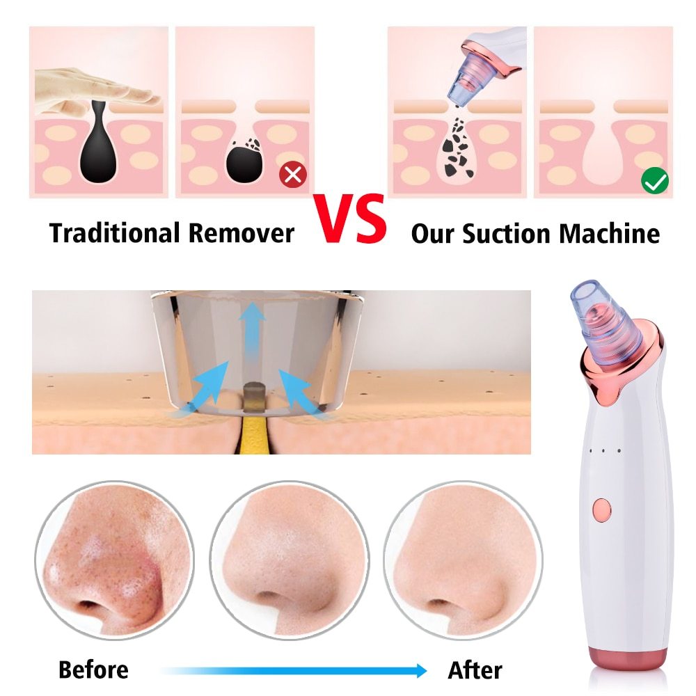 Electric Blackhead Suction Facial Washing Instrument