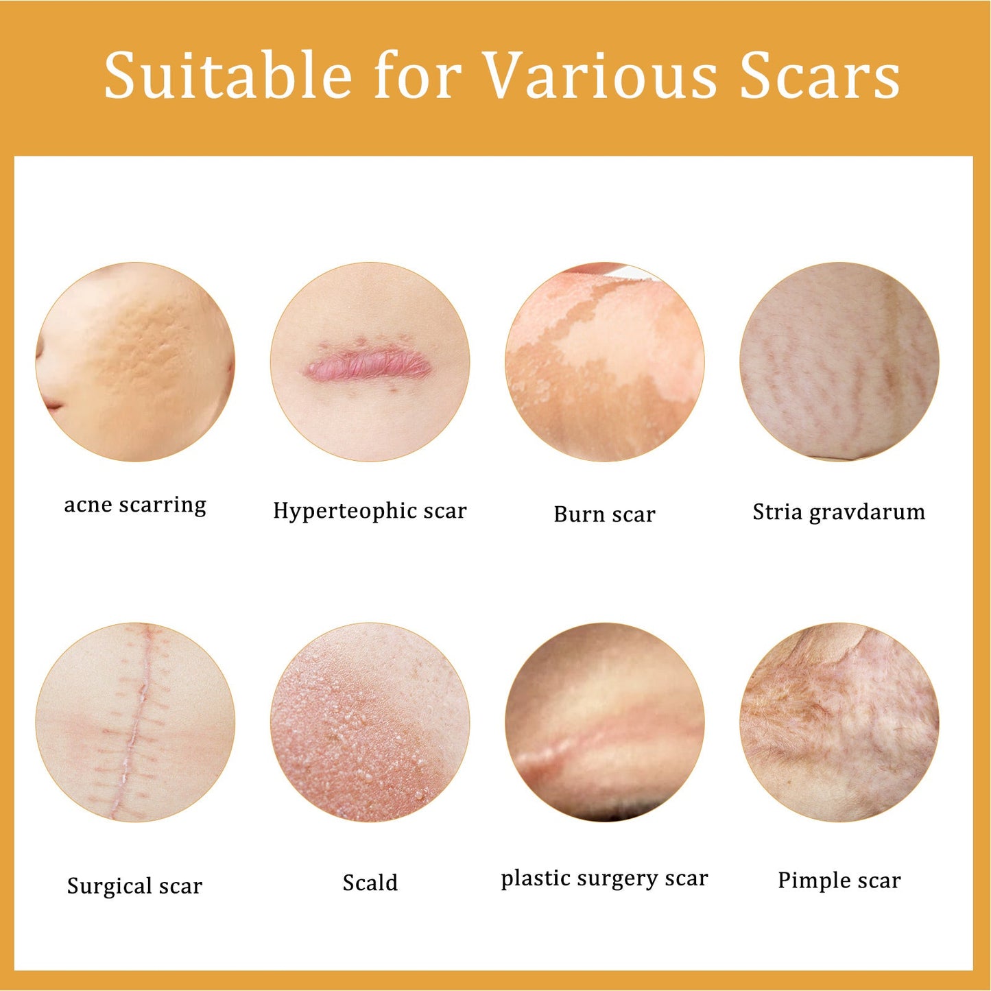 Desalting Skin Scar Cream, Skin Burn Scalding Surgical Scar Wound Repair Cream