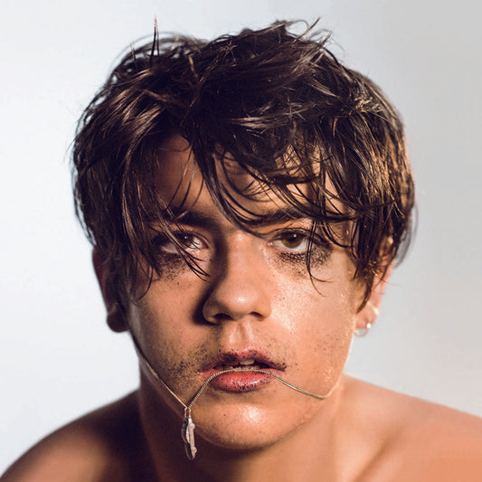 Declan McKenna - What Do You Think About The Car? [Translucent Yellow LP] Vinyl Record