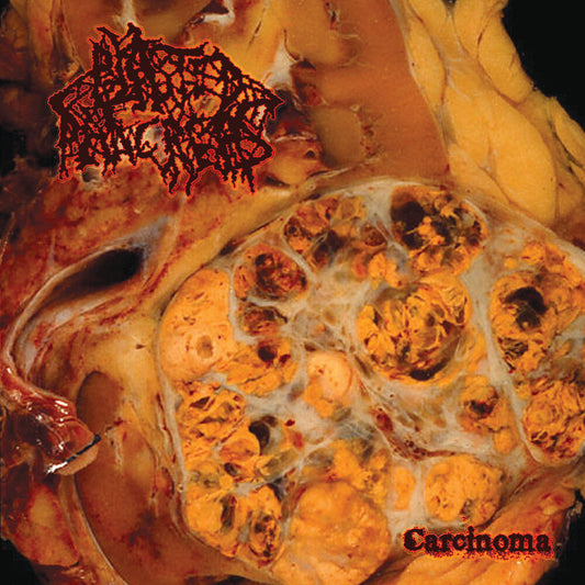 Blasted Pancreas - Carcinoma [Colored Vinyl] [Limited Edition] (Red) Vinyl Record
