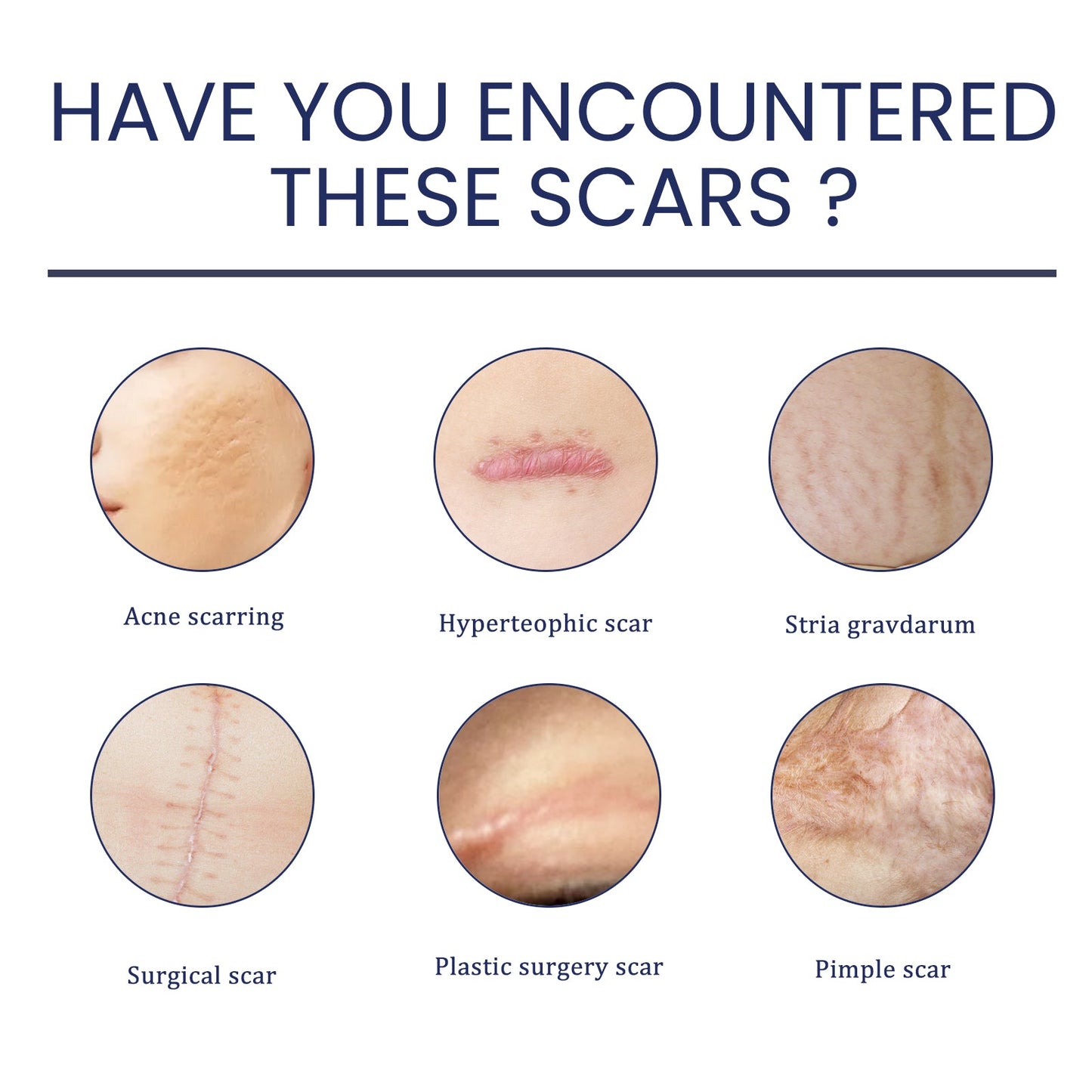 Scar Gel, Fade Skin Scar Pregnancy Surgery Scar Moisturizing Skin Care Gel