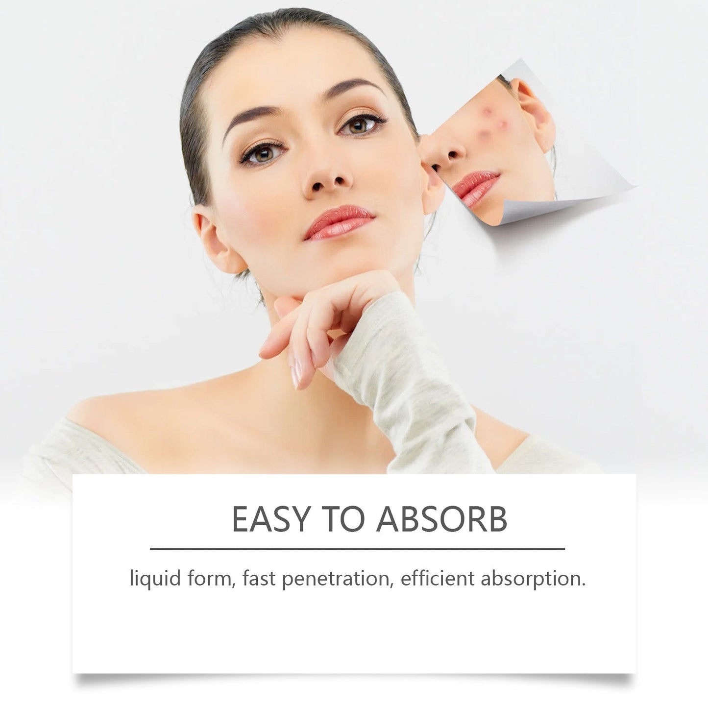 Eczema Herbal Drops Body Treatment