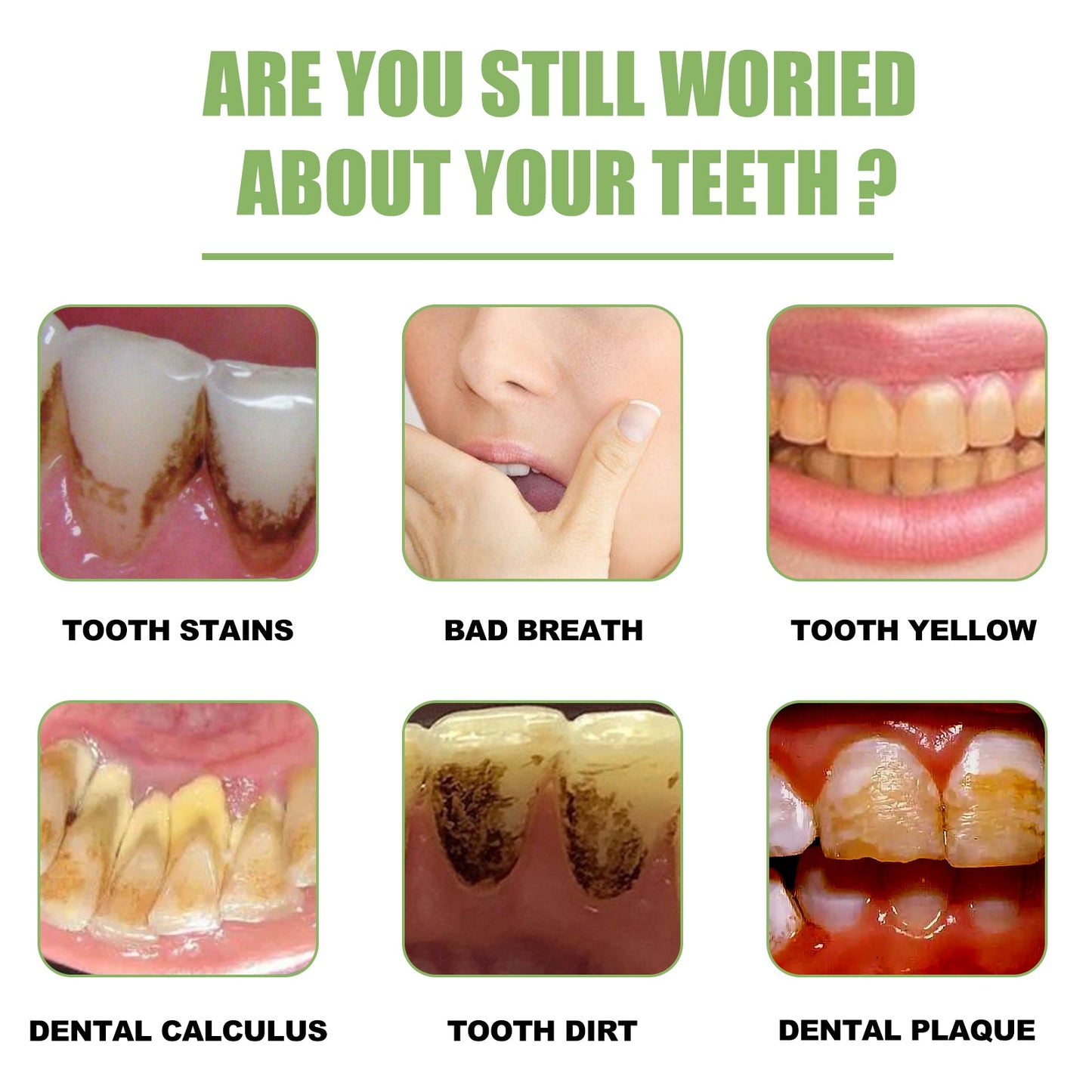 Teeth Whitening Serum To Remove Stains, Bad Breath, Whitening Teeth And Whitening Teeth
