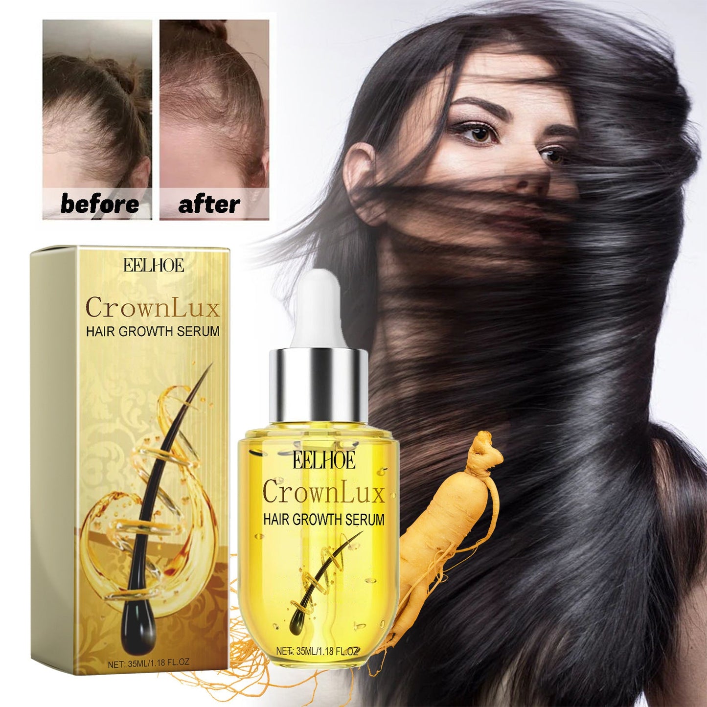 Hair Growth Serum, Prevent Fixation And Nourish Thick Hair And Scalp