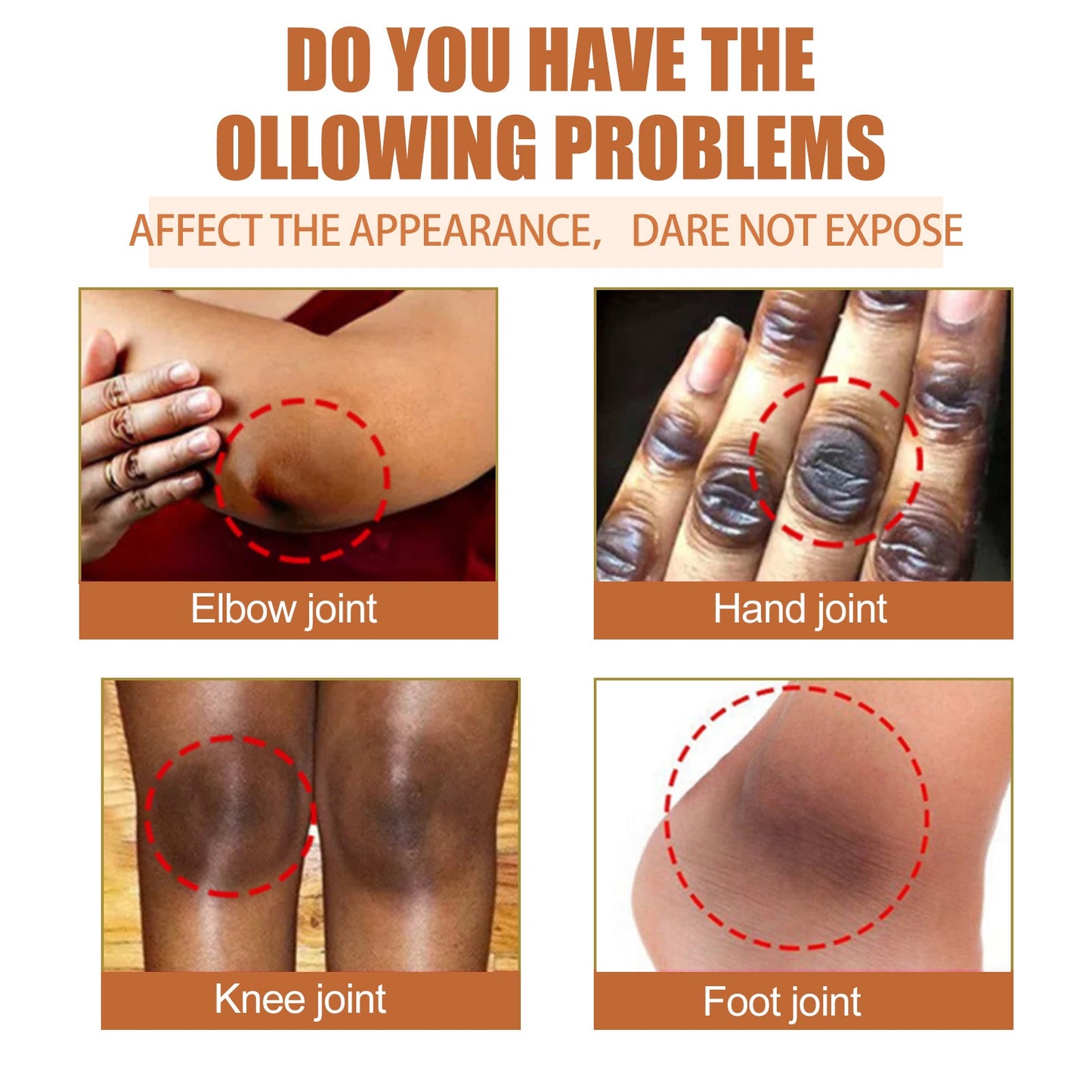 Papaya Seed Skin Care Oil Lightening Dark Spots, Bending Joints, Elbows, Brightening Skin And Moisturizing Oil