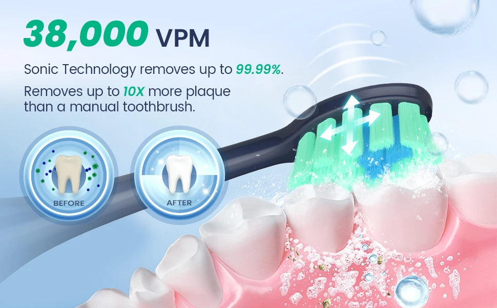 SmileRush Pro Sonic Toothbrush – 38,000 Vibes Per Minute of Pure Happy-Clean Energy!