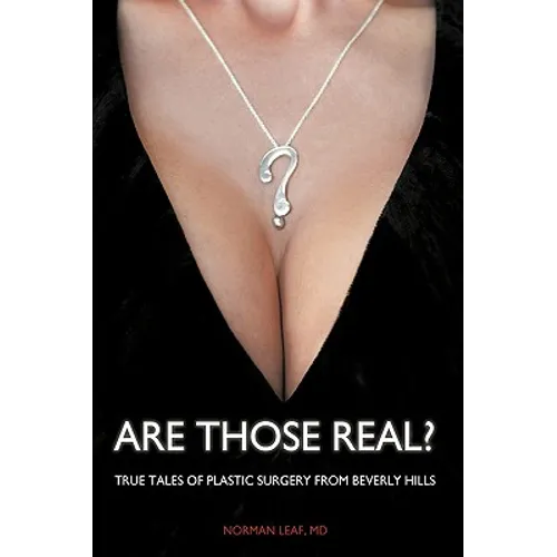 Are Those Real?: True Tales of Plastic Surgery from Beverly Hills